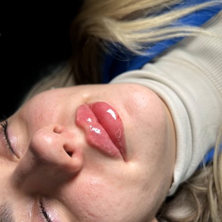 dental-block-1-before-after-opt