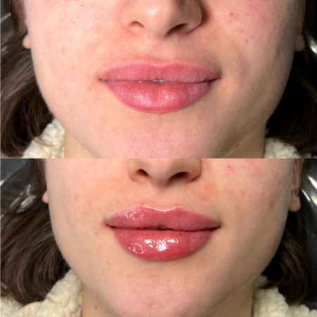 dental-block-before-after-3